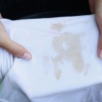 How to Remove Old Stains from Clothes?