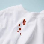 How to Remove Blood Stains from Clothes: Effective Tips and Techniques